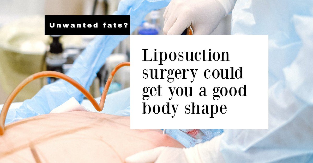 Hate Those Extra Fat? Remove It With Liposuction